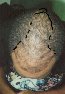 Men, hair transplant photo, 30 years old